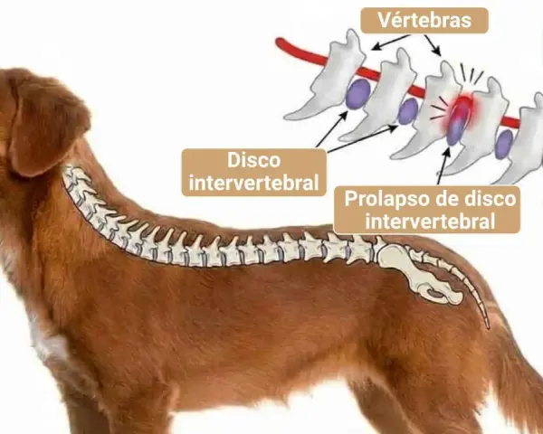 Ilustración de la columna vertebral de un perro, mostrando un disco intervertebral prolapsado. La imagen explica la causa de dolor y la posible decisión de sacrificar perro por hernia discal.